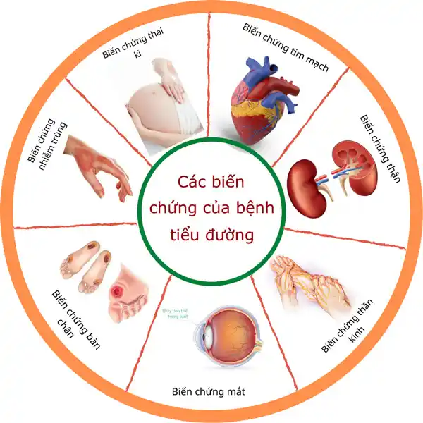 Nấm Linh Chi Trị Bệnh Tiểu Đường 6 Bien Chung Cua Benh Tieu Duong