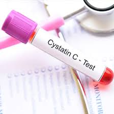 Chẩn đoán bệnh thận bằng xét nghiệm Cystatin C 1 Xét Nghiệm Bệnh Thận