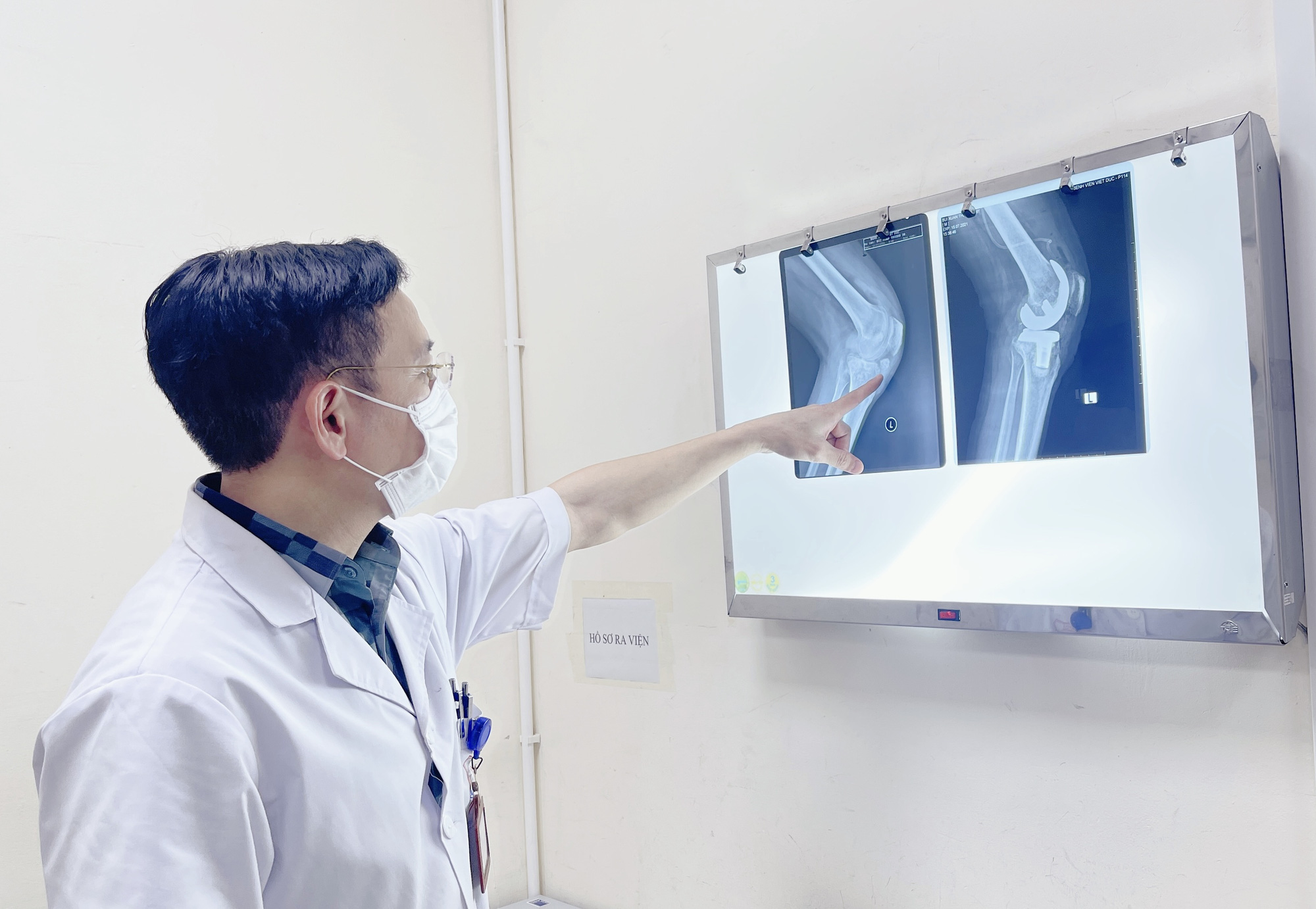 Bệnh Gút: Từ Hiểu Biết đến Chiến Thắng Cơn Đau 3 Chẩn đoán Bệnh Gout