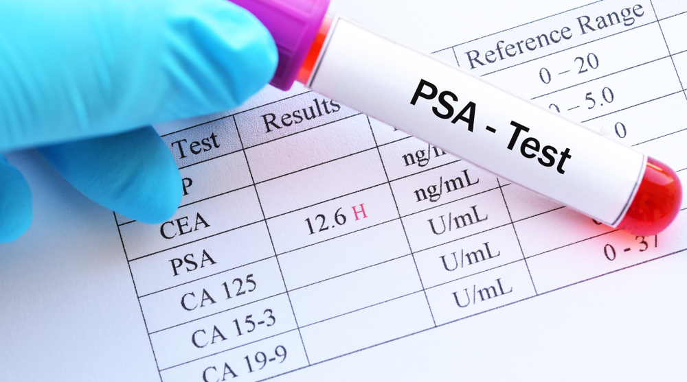 Ung thư tuyến tiền liệt: Vượt qua thử thách, hướng tới cuộc sống khỏe mạnh 4 Psa Test