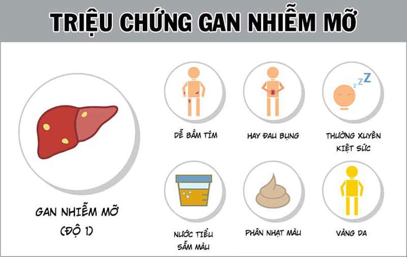 Men Gan Cao, Gan Nhiễm Mỡ Độ 3, và Những Nguy Cơ Tiềm Ẩn Cho Sức Khỏe 5 Triệu Chứng Gan Nhiễm Mỡ
