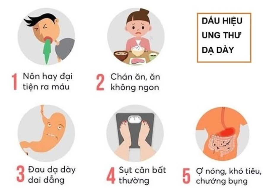 Ung thư dạ dày: Không đầu hàng, chiến thắng đang chờ 2 Triệu Chứng Ung Thư Dạ Dày