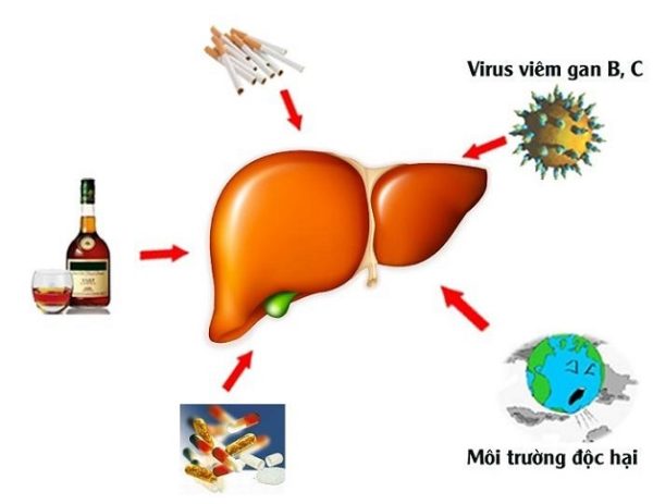 Bệnh Xơ Gan Có Lây Không