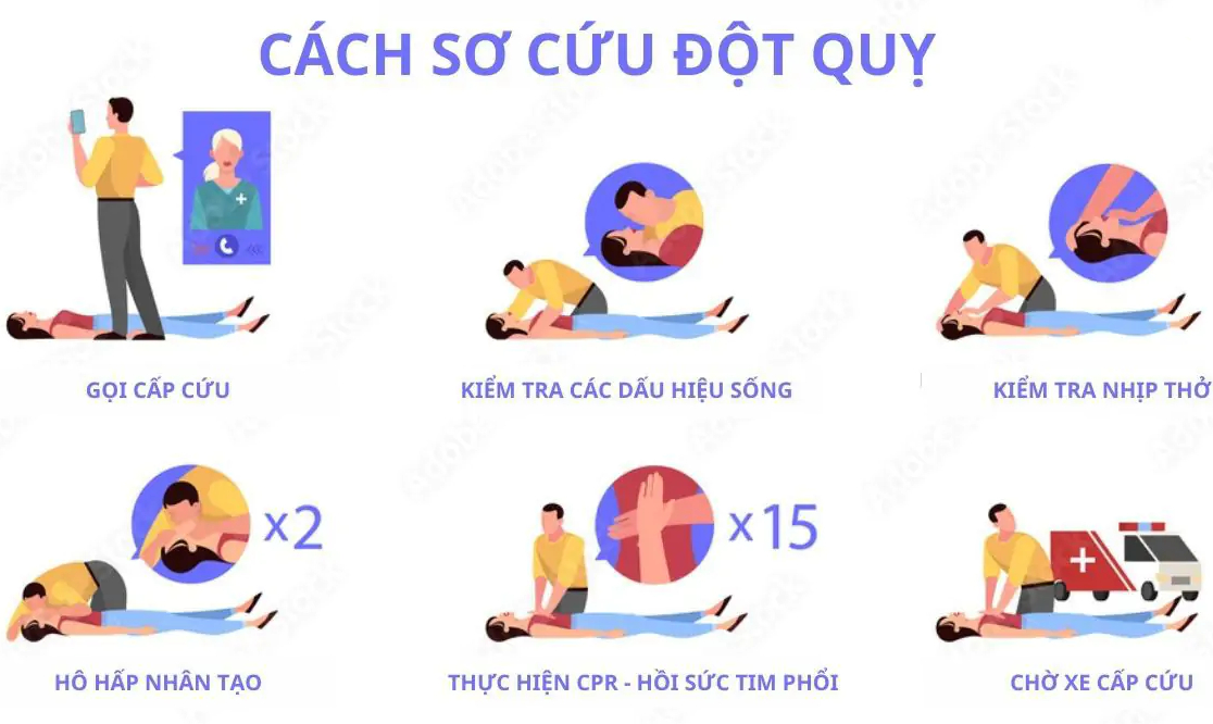 Đột quỵ: Hiểu rõ để phòng tránh và bảo vệ sức khỏe 3 Sơ Cứu đột Quỵ
